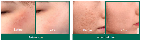 SOMEBYMI Snail TrueCICA Miracle Repair Serum